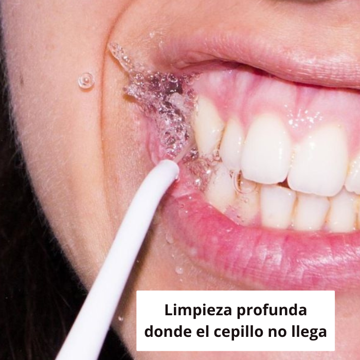 SmileFresh Pro - Hilo dental profesional en casa