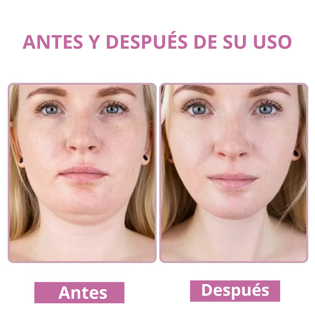 Mascarilla facial V-Lift Mask